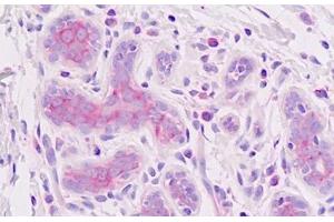 Human Breast, Epithelium: Formalin-Fixed, Paraffin-Embedded (FFPE) (EIF3E anticorps)