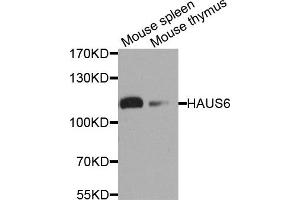 Western blot analysis of extract of mouse spleen and mouse thymus cells, using HAUS6 antibody. (FAM29A anticorps)