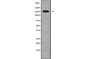 Western blot analysis NID2 using K562 whole cell lysates (NID2 anticorps)