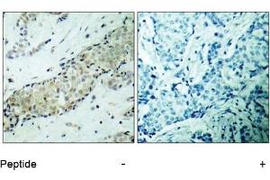Image no. 2 for anti-Histone Deacetylase 5 (HDAC5) (AA 496-500) antibody (ABIN197341) (HDAC5 anticorps  (AA 496-500))