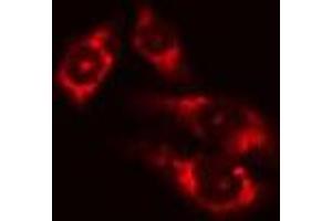 ABIN6275046 staining Hela cells by IF/ICC. (ATG4D anticorps  (C-Term))