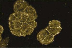 Immunofluorescence staining of A431 cells (Human epithelial carcinoma, ATCC CRL-1555). (FKBP10 anticorps  (AA 434-576))