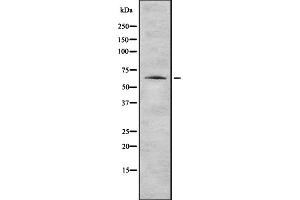 Western blot analysis of K2C1 expression in HEK293 cells ,The lane on the left is treated with the antigen-specific peptide. (Cytokeratin 1 anticorps  (N-Term))
