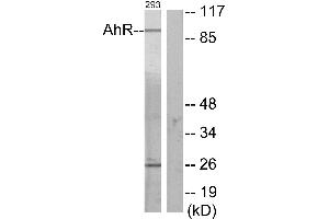 Immunohistochemistry analysis of paraffin-embedded human thyroid gland tissue using AhR (Ab-36) antibody. (Aryl Hydrocarbon Receptor anticorps)