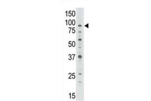 Western Blotting (WB) image for anti-ATP-Binding Cassette, Sub-Family B (MDR/TAP), Member 7 (ABCB7) antibody (ABIN3002511) (ABCB7 anticorps)