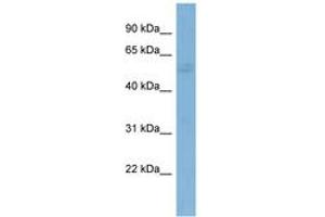 Image no. 1 for anti-GTPase Activating Protein (SH3 Domain) Binding Protein 1 (G3BP1) (AA 107-156) antibody (ABIN6742009) (G3BP1 anticorps  (AA 107-156))