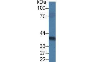 Detection of PRLR in Rat Serum using Polyclonal Antibody to Prolactin Receptor (PRLR) (Prolactin Receptor anticorps  (AA 20-229))