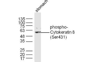 Mouse stomach lysates probed with Cytokeratin 8 (Ser431) Polyclonal Antibody, Unconjugated  at 1:300 dilution and 4˚C overnight incubation. (KRT8 anticorps  (pSer431))