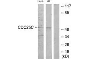 Western Blotting (WB) image for anti-Cell Division Cycle 25 Homolog C (S. Pombe) (CDC25C) (AA 183-232) antibody (ABIN2888961) (CDC25C anticorps  (AA 183-232))