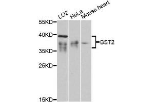 Western blot analysis of extracts of various cell lines, using BST2 antibody (ABIN5997320) at 1:3000 dilution. (BST2 anticorps)