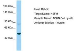 Image no. 1 for anti-Neurofilament Triplet M Protein (NEFM) (AA 429-478) antibody (ABIN6750015) (NEFM anticorps  (AA 429-478))