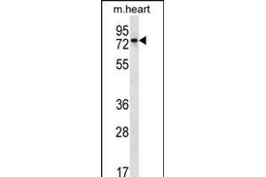 RP2 Antibody (C-term) (ABIN656279 and ABIN2845589) western blot analysis in mouse heart tissue lysates (35 μg/lane). (PARP2 anticorps  (C-Term))