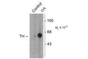 Image no. 1 for anti-Tyrosine Hydroxylase (TH) (pSer31) antibody (ABIN227933) (Tyrosine Hydroxylase anticorps  (pSer31))