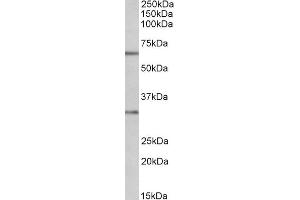 ABIN768625 (1µg/ml) staining of MOLT4 lysate (35µg protein in RIPA buffer). (Caspase 3 anticorps  (Internal Region))