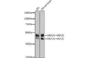Western blot analysis of extracts of various cell lines, using MEF2A+MEF2C antibody (ABIN1679049, ABIN1679050, ABIN7101495 and ABIN7101496) at 1:1000 dilution. (MEF2A+MEF2C anticorps)