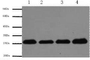 Western Blotting (WB) image for anti-Proliferating Cell Nuclear Antigen (PCNA) antibody (ABIN5957357) (PCNA anticorps)