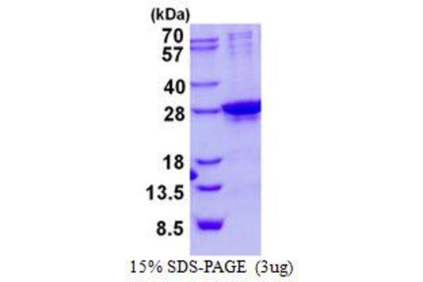 SIX Homeobox 6 Protein (SIX6) (His tag)