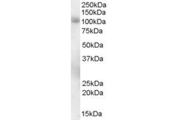 PDE5A anticorps  (C-Term)