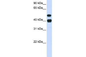 WB Suggested Anti-USP22 Antibody Titration: 0. (USP22 anticorps  (N-Term))
