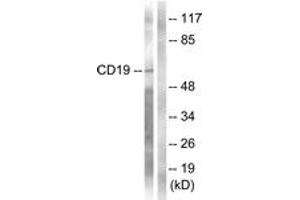 Western blot analysis of extracts from COS7 cells, treated with Serum 10% 30', using CD19 (Ab-531) Antibody. (CD19 anticorps  (AA 501-550))