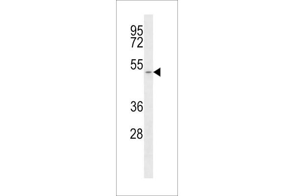 SLC16A1 anticorps  (C-Term)