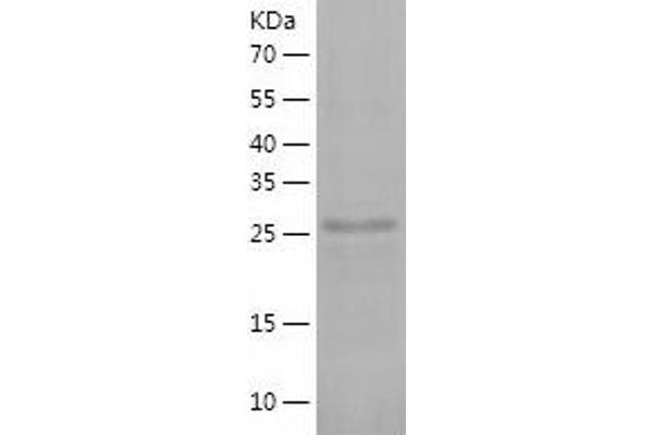 PITPNM2 Protein (AA 162-435) (His tag)