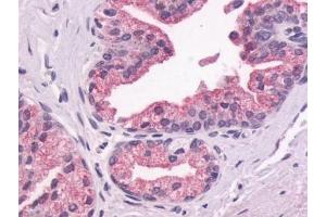 Immunohistochemical staining of Prostate (Epithelium) using anti- GPR87 antibody ABIN122192 (GPR87 anticorps  (N-Term))