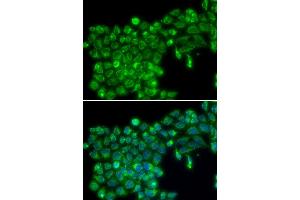 Immunofluorescence analysis of MCF7 cell using TNFSF13 antibody. (TNFSF13 anticorps)