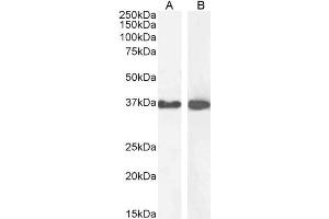 Western Blotting (WB) image for anti-Glyceraldehyde-3-Phosphate Dehydrogenase (GAPDH) (C-Term) antibody (ABIN185240)