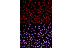 Immunofluorescence analysis of U2OS cells using POLH antibody (ABIN5970934). (POLH anticorps)