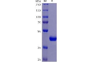 Human TNFB Protein, mFc Tag on SDS-PAGE under reducing condition. (TNFRSF10B Protein (AA 56-186) (mFc Tag))