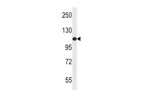 Western blot analysis in ZR-75-1 cell line lysates (35ug/lane). (USO1 anticorps  (C-Term))