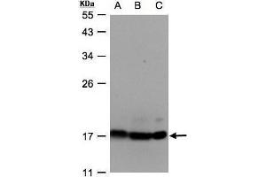 WB Image Sample(30 ug whole cell lysate) A:Hep G2, B:MOLT4, C:Raji, 12% SDS PAGE antibody diluted at 1:500 (ATP Synthase delta (Center) anticorps)