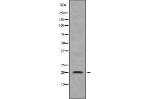 Western blot analysis IMMP2L using HepG2 whole cell lysates (IMMP2L anticorps  (Internal Region))
