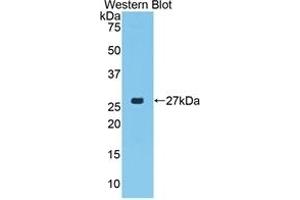 Detection of Recombinant CTGF, Porcine using Polyclonal Antibody to Connective Tissue Growth Factor (CTGF) (CTGF anticorps  (AA 101-330))