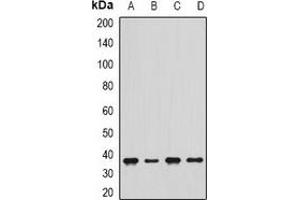 Western blot analysis of delta-Sarcoglycan expression in Jurkat (A), THP1 (B), mouse skeletal muscle (C), rat heart (D) whole cell lysates. (SGCD anticorps)