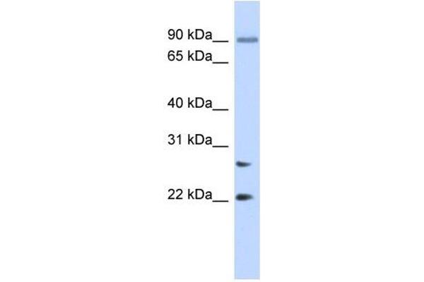 JOSD2 anticorps  (N-Term)