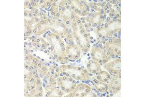 Immunohistochemistry of paraffin-embedded mouse kidney using PRDX5 antibody (ABIN5973743) at dilution of 1/200 (40x lens). (Peroxiredoxin 5 anticorps)
