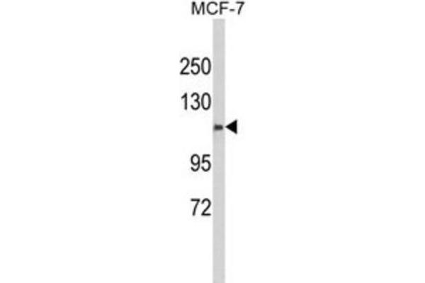 CXorf22 anticorps