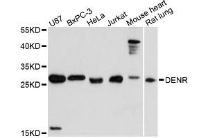 Western blot analysis of extracts of various cell lines, using DENR antibody (ABIN6294200) at 1:3000 dilution. (Density Regulated Protein anticorps)