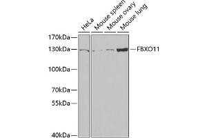 Western blot analysis of extracts of various cell lines, using FBXO11 antibody (ABIN6130885, ABIN6140512, ABIN6140513 and ABIN6221761) at 1:1000 dilution. (FBXO11 anticorps  (AA 688-927))