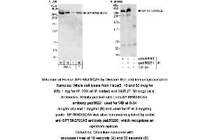 Image no. 1 for anti-Spectrin, Beta, Non-erythrocytic 2 (SPTBN2) (AA 2300-2390), (C-Term) antibody (ABIN363600) (Spectrin, Beta, Non-erythrocytic 2 (SPTBN2) (AA 2300-2390), (C-Term) anticorps)