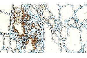 Human Thyriod: immunohistochemical staining of Thyroglobulin in the follicular epithelial cells. (Thyroglobulin anticorps)