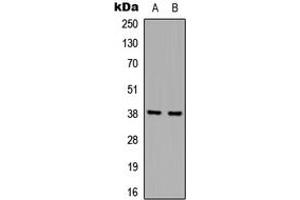 Western blot analysis of hnRNP D0 expression in A431 (A), Jurkat (B) whole cell lysates. (HNRNPD/AUF1 anticorps  (Center))