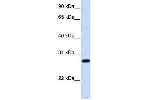 DCK antibody used at 1 ug/ml to detect target protein. (DCK anticorps  (Middle Region))
