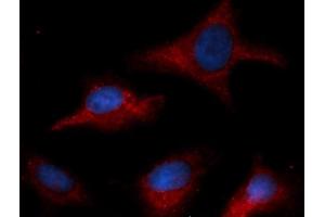 Immunofluorescence (IF) image for anti-Coagulation Factor III (thromboplastin, Tissue Factor) (F3) antibody (APC) (ABIN5567677) (Tissue factor anticorps  (APC))