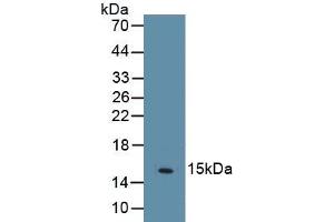 Detection of Recombinant PPARg, Human using Monoclonal Antibody to Peroxisome Proliferator Activated Receptor Gamma (PPARg) (PPARG anticorps  (AA 157-274))