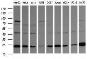 Image no. 5 for anti-RAB21, Member RAS Oncogene Family (RAB21) antibody (ABIN1500542) (RAB21 anticorps)