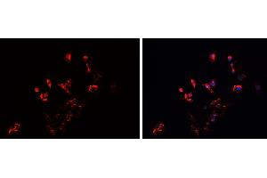 ABIN6279542 staining HEPG2 cells by IF/ICC. (IMMP2L anticorps  (Internal Region))