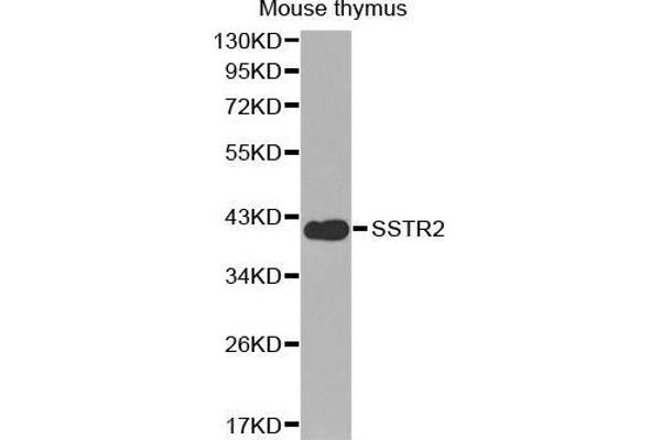 SSTR2 anticorps  (C-Term)